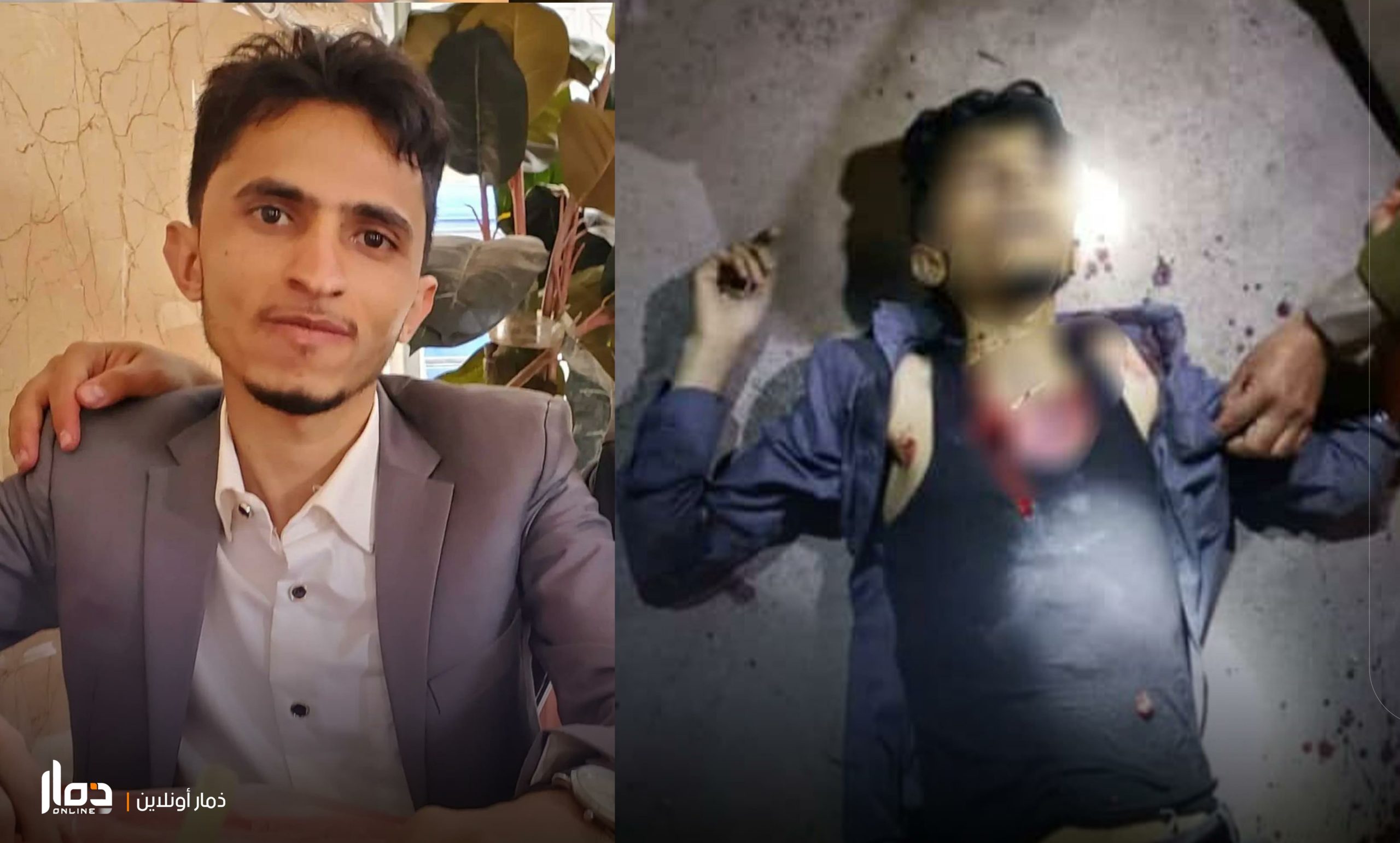 مقتل طالب طب “امتياز” برصاص مسلح في مستشفى جامعي بذمار